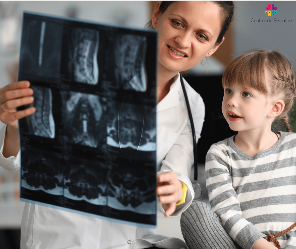prognostic scolioza_Centrul de Pediatrie